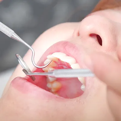 イメージ：治療の様子