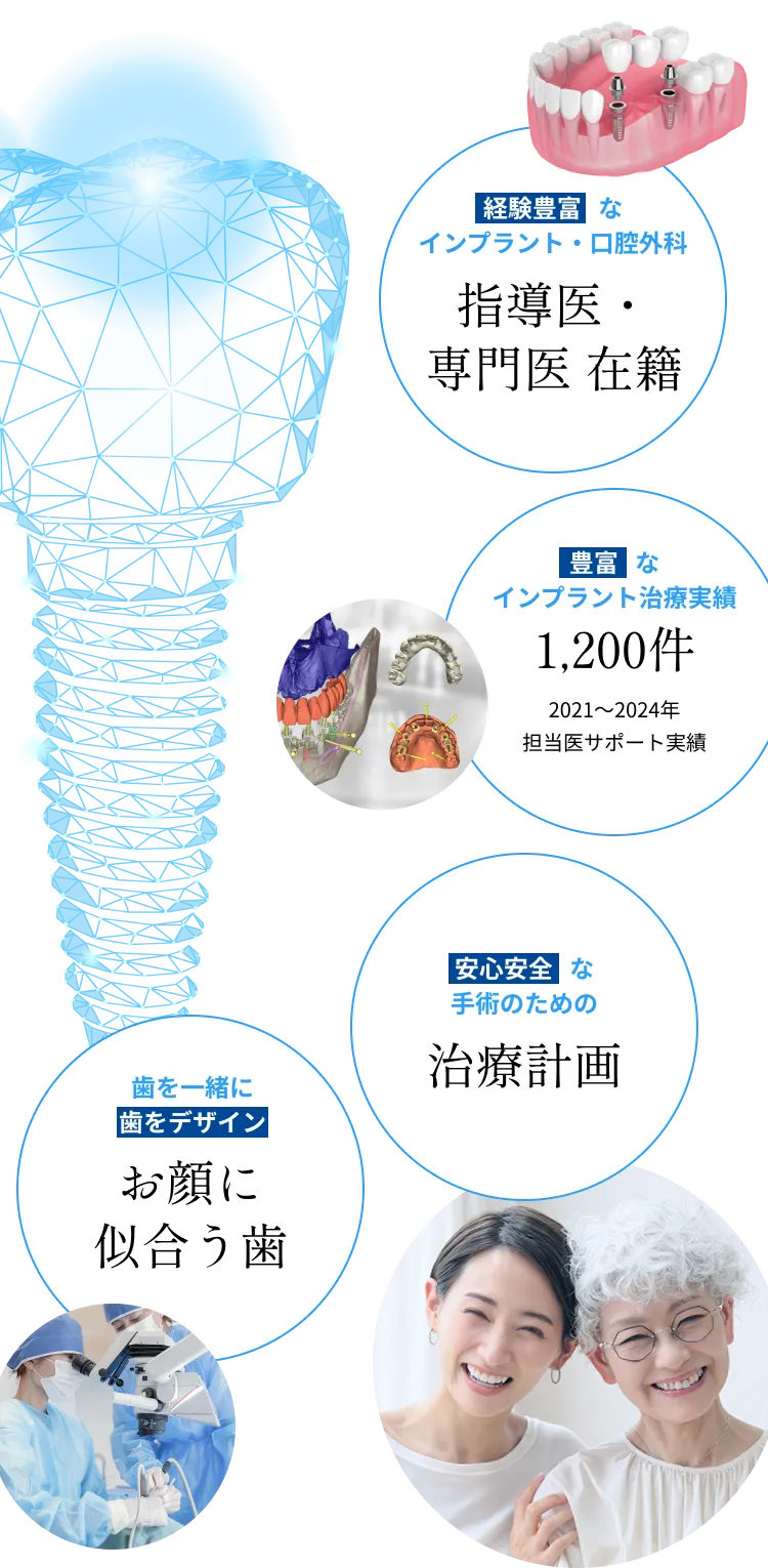豊富なインプラント治療実績 経験豊富なインプラント・口腔外科指導医・専門医在籍 安心安全な手術のための治療計画 医師を一緒に歯をデザインお顔に似合う歯