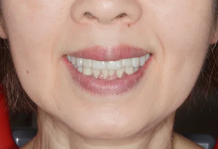お顔に調和するデザインで自然な美しさになる