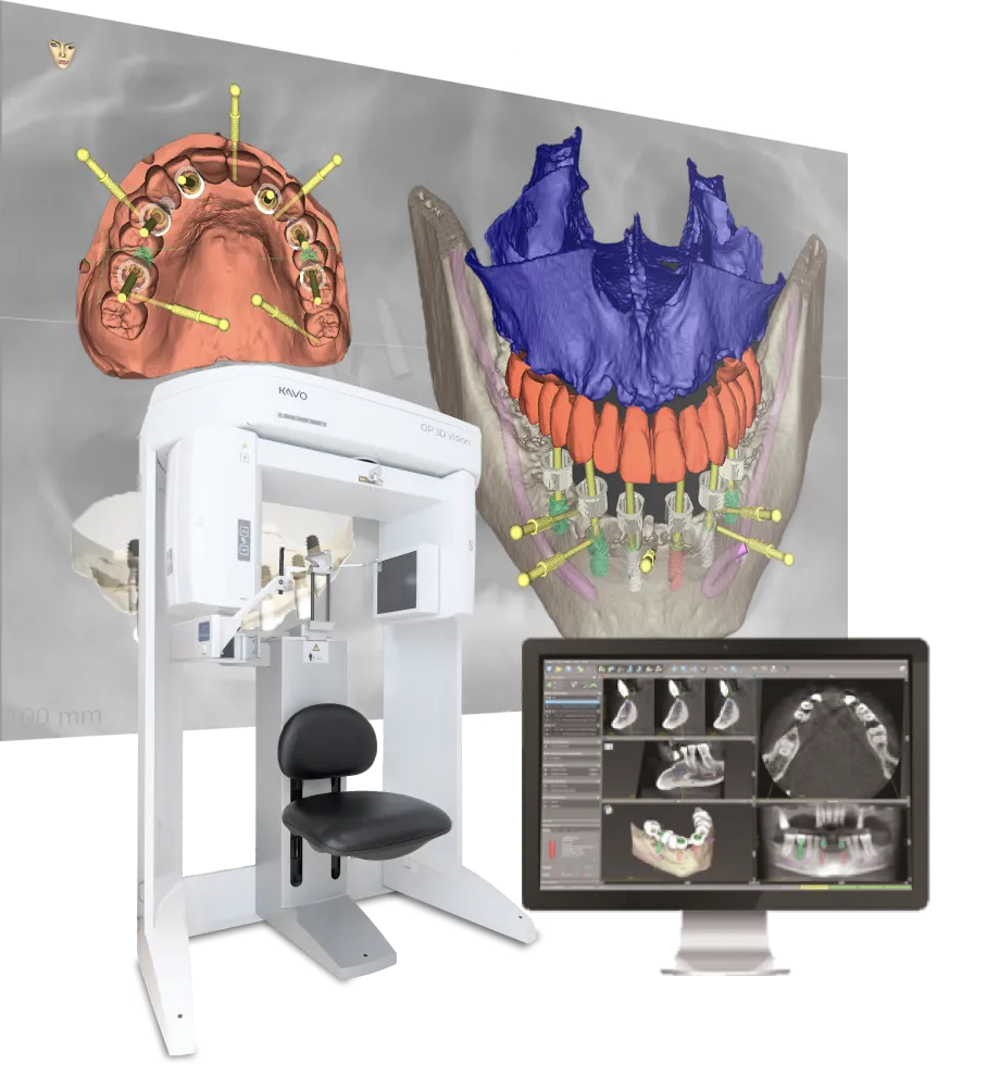 イメージ：3D CT