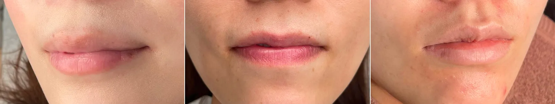 ビフォア写真