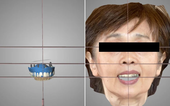 イメージ：歯をデザインする様子