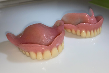 写真：従来のレジン床義歯